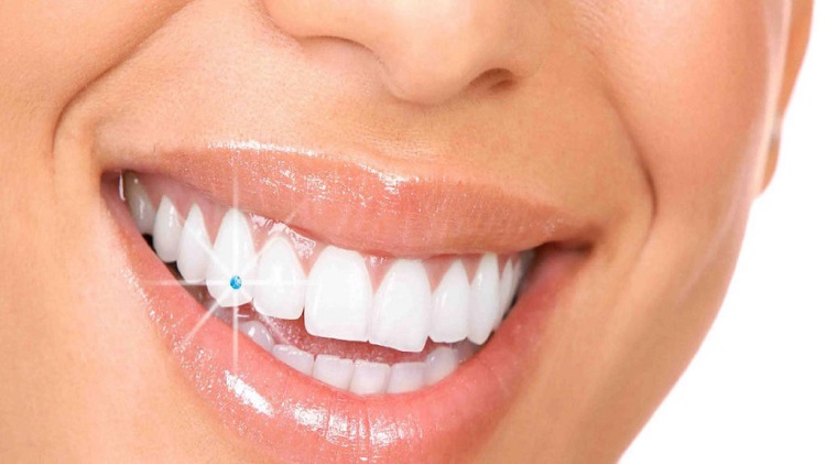 Tooth Jewellery Treatment