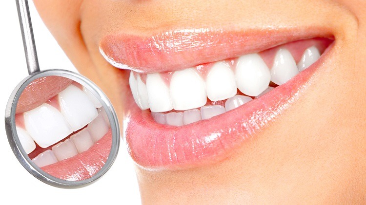 Tooth whitening